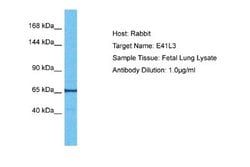 EPB41L3 Rabbit anti-Human, Polyclonal, Novus Biologicals 0.1 mL | Buy Online | Novus Biologicals | Fisher Scientific